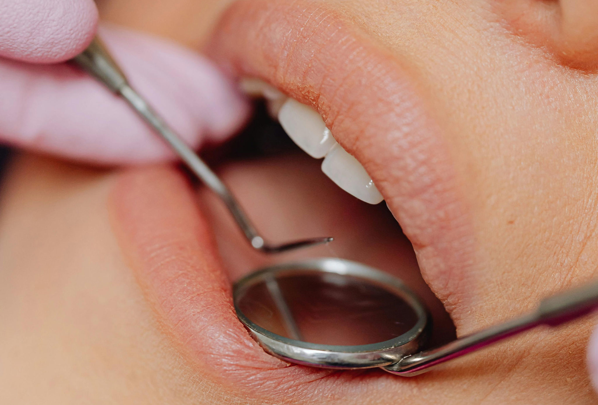 Specchio Dentale Raschietto Pr-006 Set Raschietto Per Tartaro Dentale - Kit Con Specchio Dentale E Scaler Per Igiene Orale, Modello PR-006 Occhiali - Foto 11