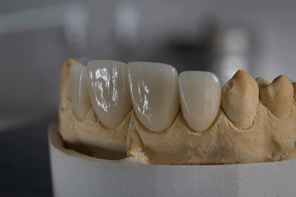 rifarsi i denti il albania