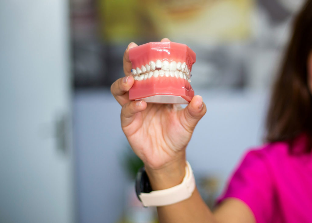 prevenzione macchie di caffè nei denti
