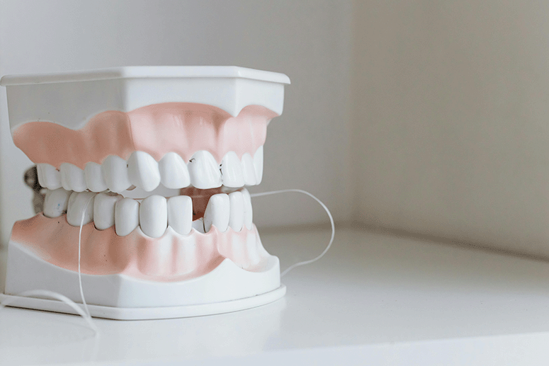 come pulire gli impianti dentali fissi con filo interdentale