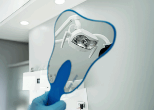 i migliori impianti dentali del mondo nel 2025